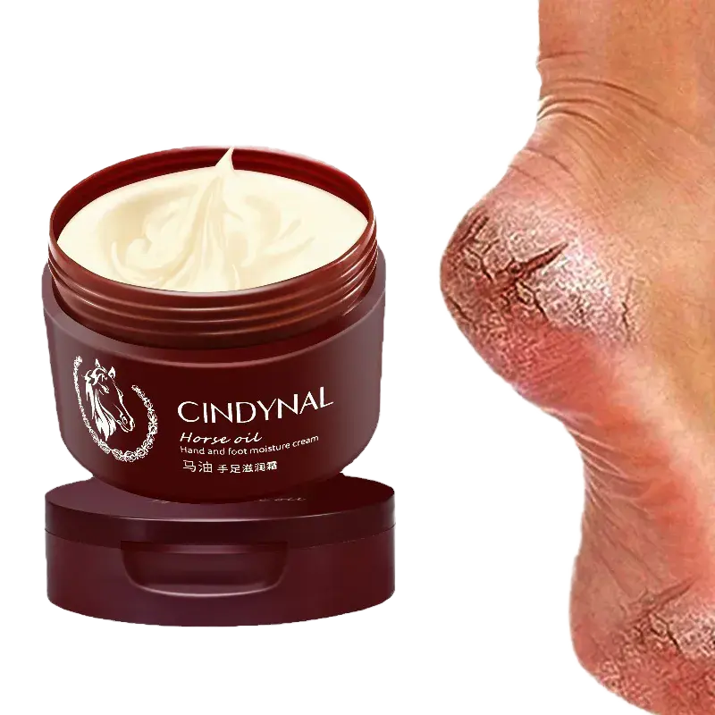 Crème Réparatrice à l'Huile de Cheval pour les Mains, les Pieds et les Talons Secs - Élimination des Peaux Mortes, Peeling, Hydratation et Exfoliation pour le Soin des Pieds
